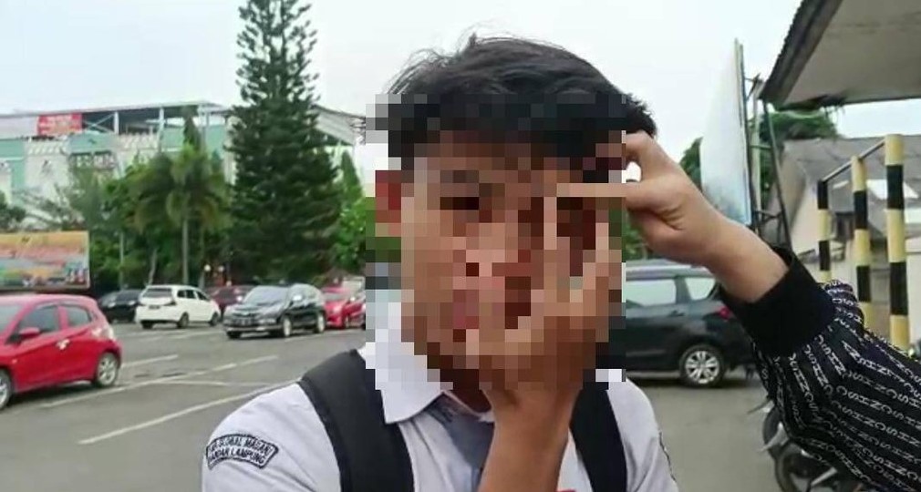 Guru Di Bandar Lampung Dilaporkan Ke Polisi Diduga Aniaya Muridnya