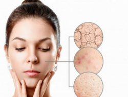 5 Tanda Skin Barrier yang Sehat, Simak Penjelasannya