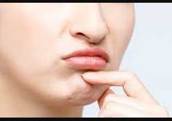 Apa itu jerawat bibir? Mengenal jerawat bibir dan cara Mengatisinya